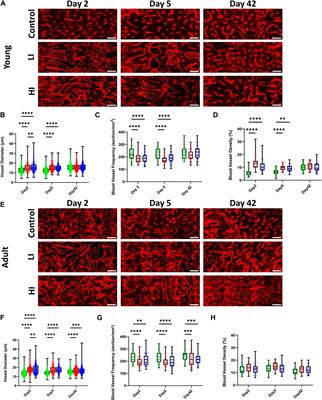Age and dose dependent changes to the bone and bone marrow microenvironment after cytotoxic conditioning with busulfan